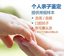 崇左匿名亲子鉴定大概多少费用